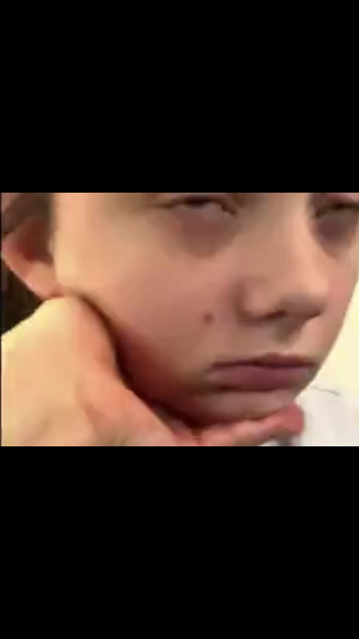 Young Girl Left With Permanent Neurological Damage From The Covid-19 Vaccine 💉