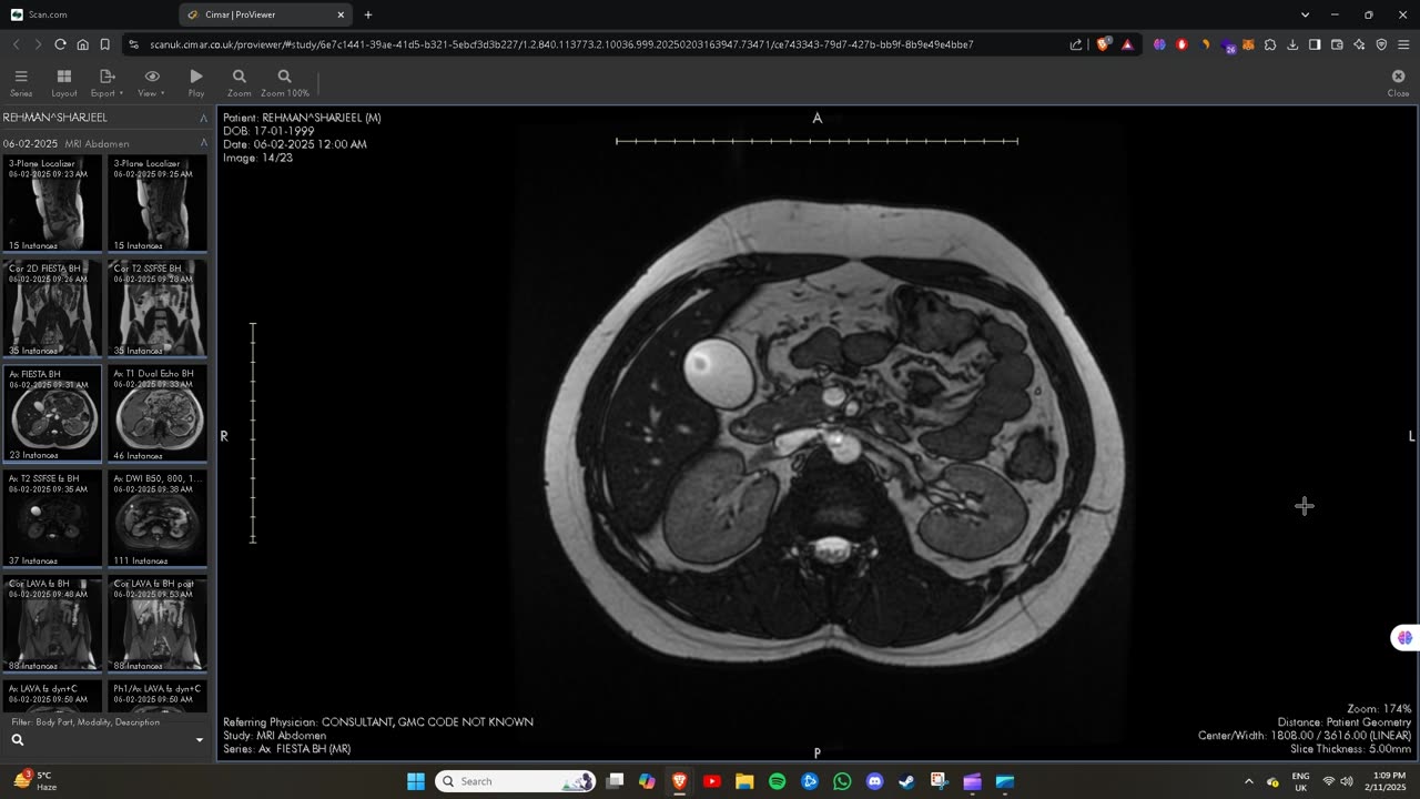 Hendon Hospital Abdomen MRI Scan Images