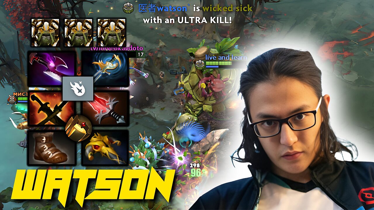 WATSON HEAVY DAMAGE HARD CARRY TINY HIGHLIGHTS