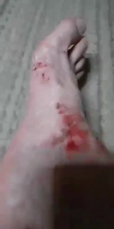 Cyraxx Not YouTube 03-27-25 Goblin foot