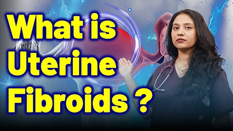 What is Fibroids Leiomyomas, Myomas ? | Treatment and Cure | Homeopathy, Medicine & Surgery