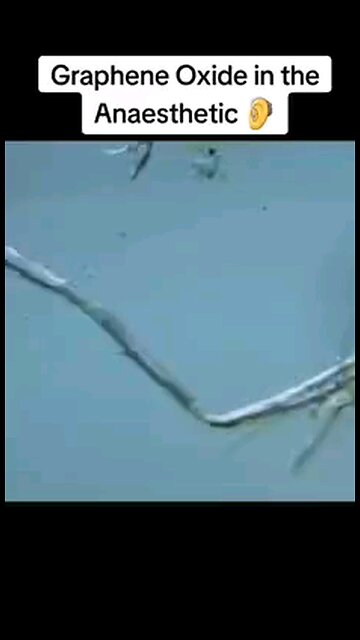 Graphene Oxide Discovered In Multiple Batches Of Anesthetics