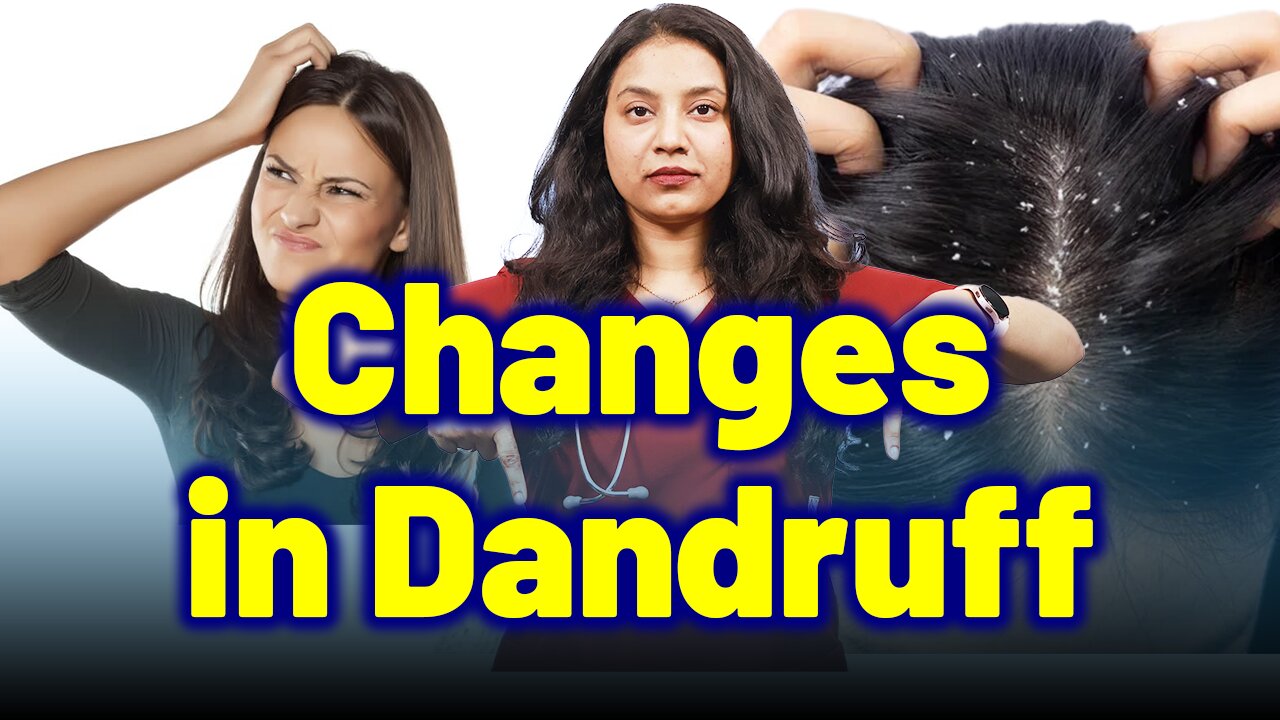 Body Changes in Dandruff, Seborrheic Dermatitis.| Treatment Cure Relief Medicine | Skin Hair Nail |