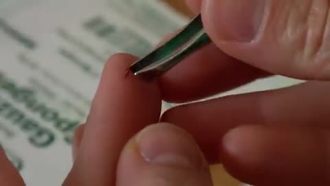 How to Remove a Splinter