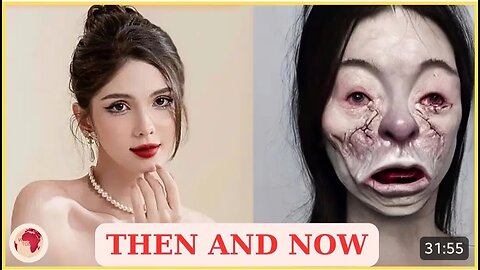55 Celebrity Plastic Surgery Disasters Full Album | Then and Now 2025