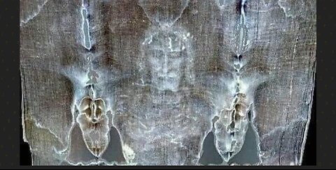 The Shroud blood type
