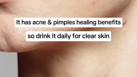 ✨ Unlock Radiant Skin: Best Tips & Foods for a Natural Glow! 🌿💖 #RadiantGlow #Skin