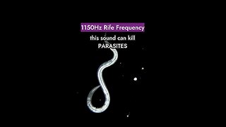 Can Frequency kills parasites ?