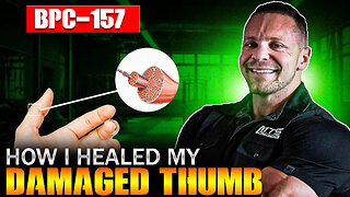 How I Healed My Mangled Thumb Without Surgery