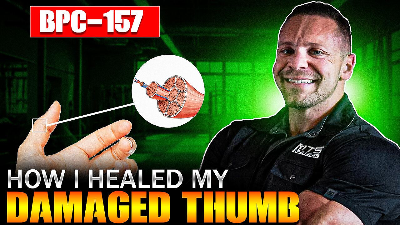 How I Healed My Mangled Thumb Without Surgery