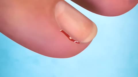 Why you shouldn't peel your hangnails