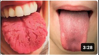 What Your Tongue Says About Your Health