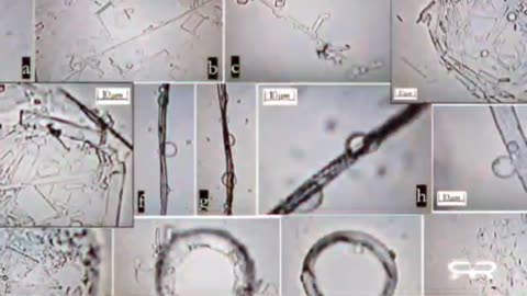 ננו בחיסונים