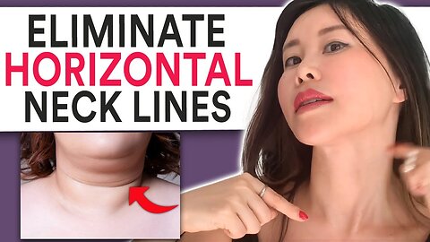 Eliminate Horizontal Neck Lines by Improving your Posture