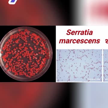 SERRATIA MARCESCENS