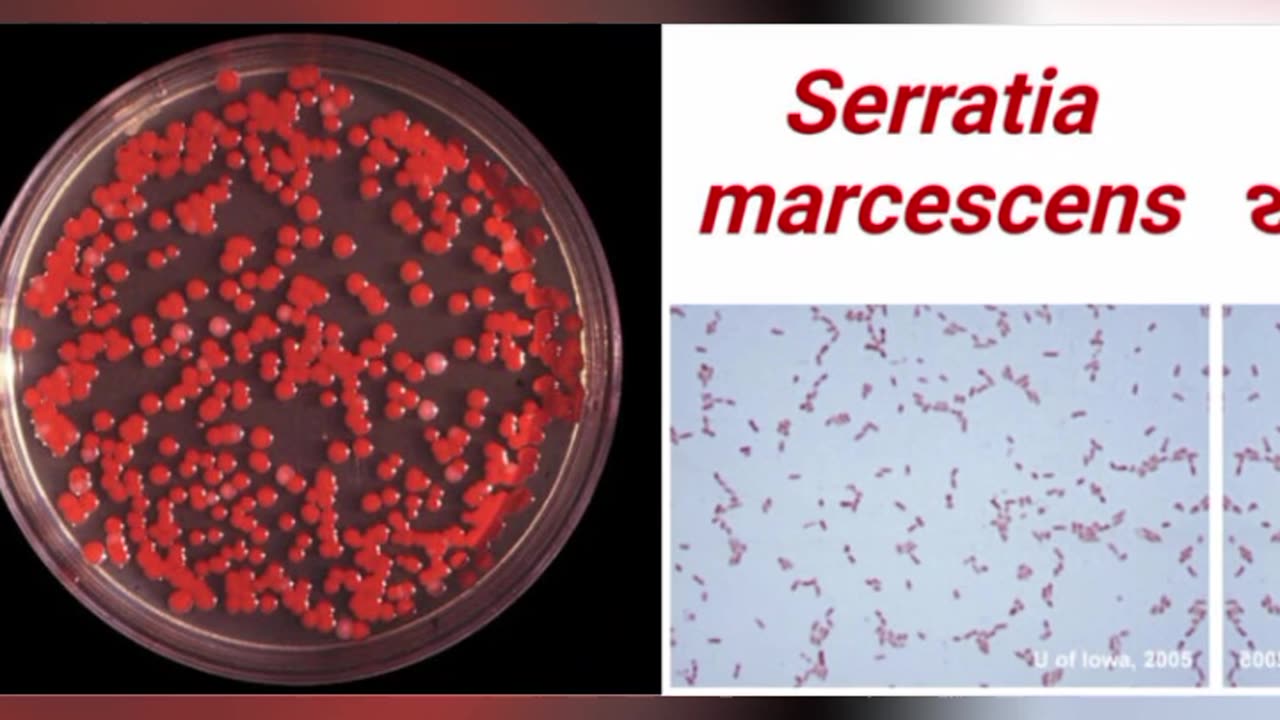 SERRATIA MARCESCENS