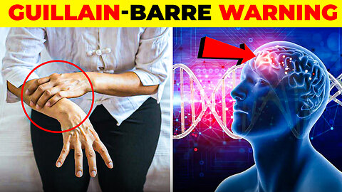 Guillain barre syndrome GBS explained