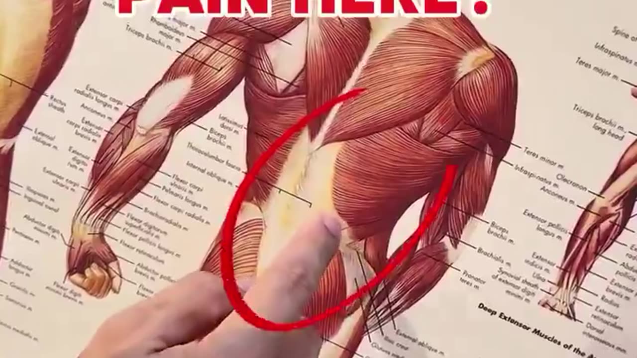 Get Rid Of One Sided Low Back Pain With This Relief Stretch!💯🔥
