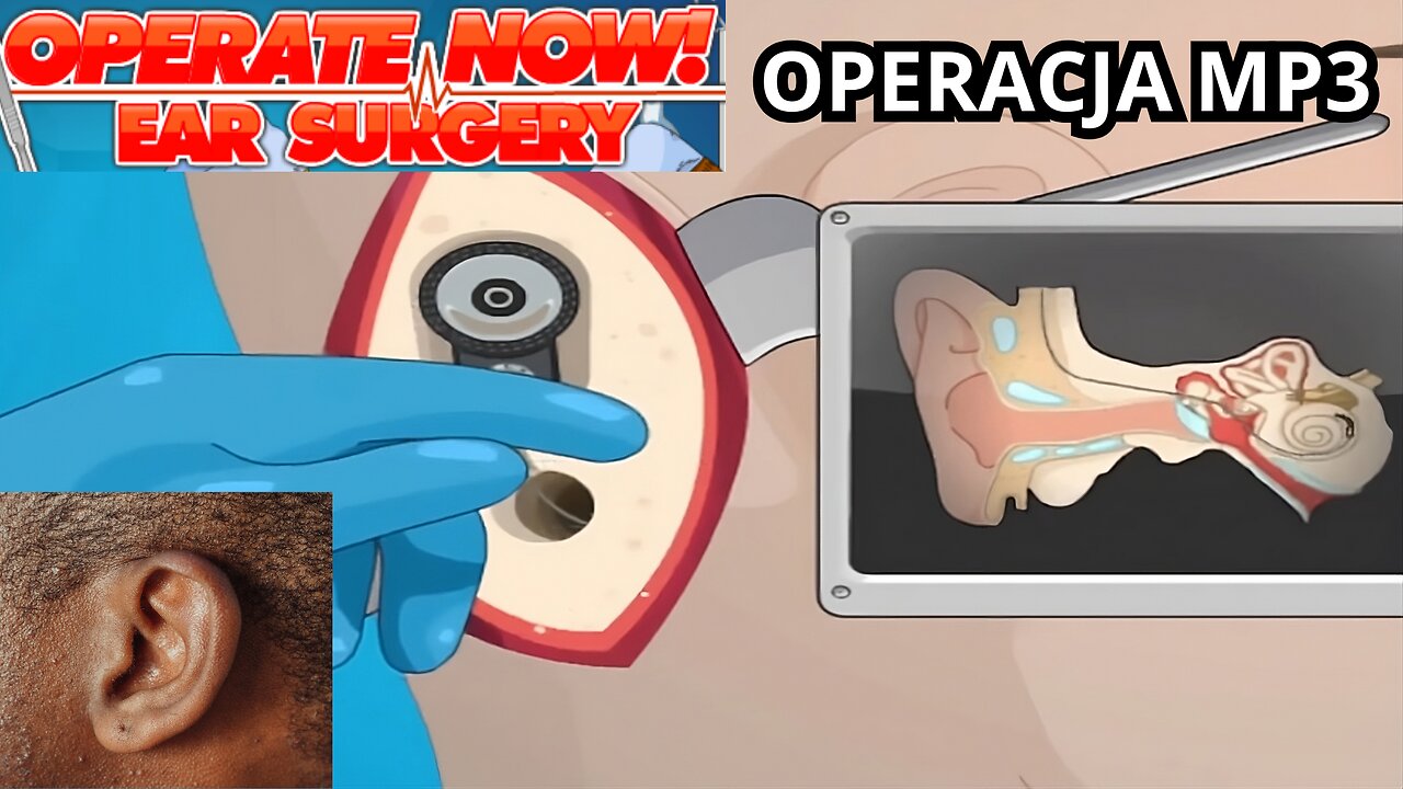 ⚡ OPERACJA MP3 | OPERATE NOW: EAR SURGERY (FLASH) ⚡