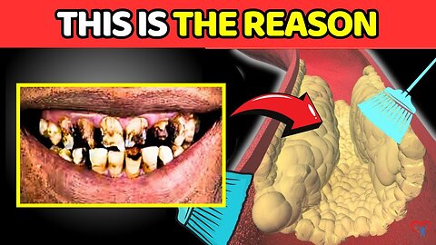 "7 Shocking Facts About Clogged Arteries You CAN’T Ignore!"