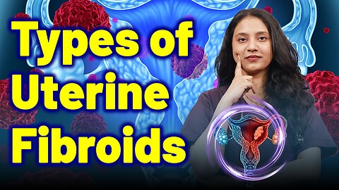Types of Uterine Fiborids | Treatment Cure Medicine Surgery | Gynaecology Women Female |