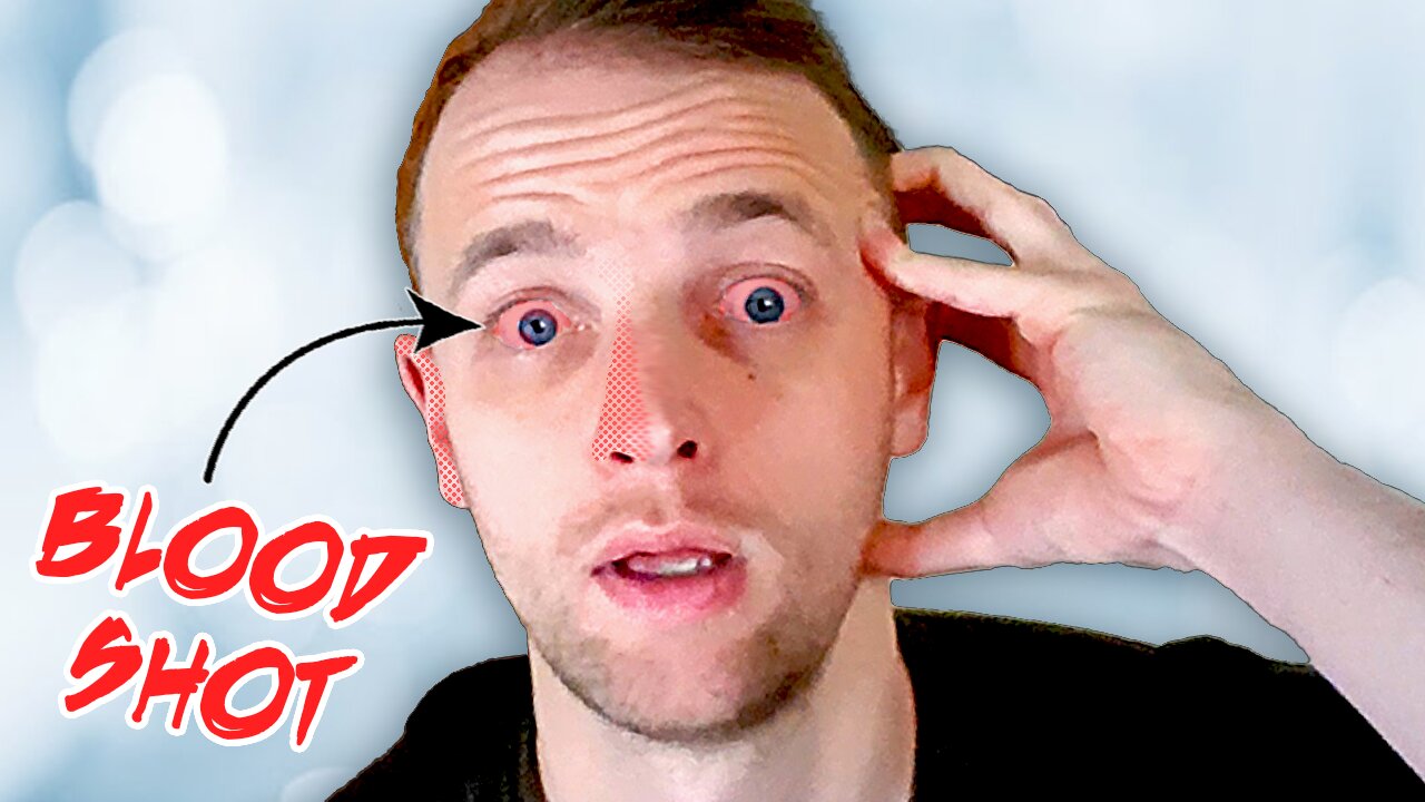 Blood shot eyes, blocked sinus' and muffled hearing? Here's the likely reason