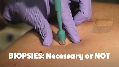 Are Biopsies Necessary or Part of the Sales Plan..? | Ward Dean MD