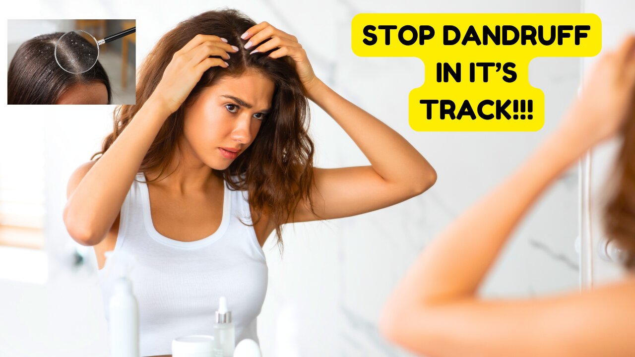 WHAT CAUSES DANDRUFF AND HOW TO GET RID OF IT?