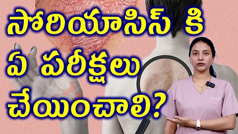 సోరియాసిస్ కి ఏ పరీక్షలు చేయించాలి ? What Tests should be done for Psoriasis? Homeopathy Treatment