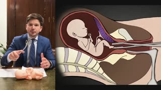 Gideon van Meijeren - Kamervoorzitter wil niet dat u dit ziet toont waarheid over abortus in Nederland