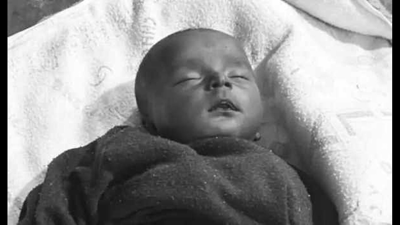 Jharkhand: 2 month old baby died following vaccination