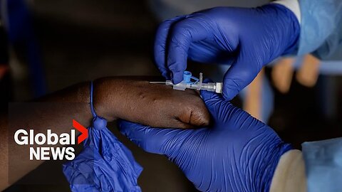 WHO investigating mystery illness in Democratic Republic of Congo