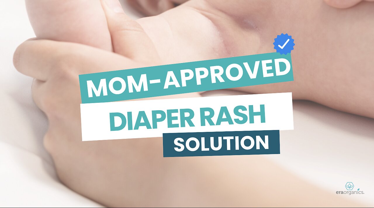 How to Prevent and Treat Diaper Rash Naturally: Tips Every Mom Needs to Know For Sensitive Skin