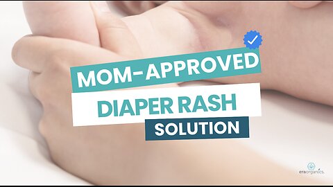 How to Prevent and Treat Diaper Rash Naturally: Tips Every Mom Needs to Know For Sensitive Skin