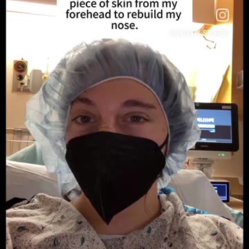 SHE WANT TO PLAY THERE FAMILY DOG, SHOCKING THE DOG BITE HER NOSE