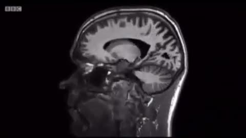 How junk food alters the neural connections in your brain, after only 4 weeks