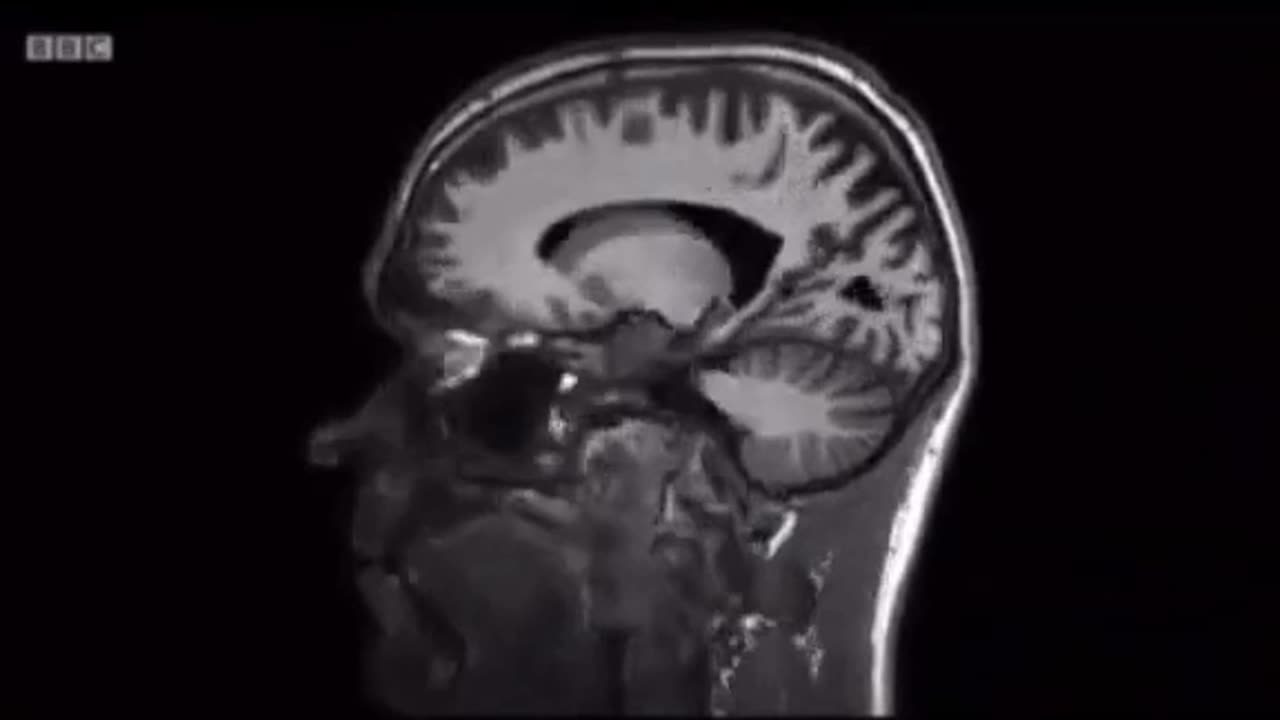 How junk food alters the neural connections in your brain, after only 4 weeks