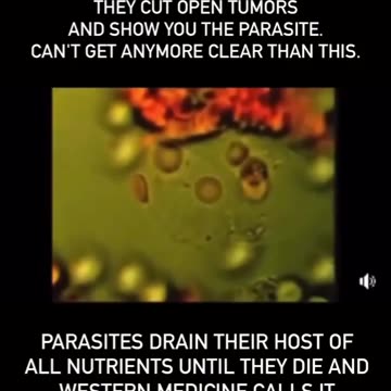 Is this why they don't want people knowing about ivermectin