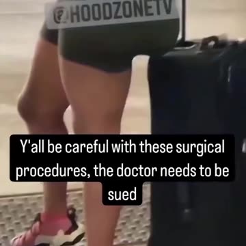 BBL Fail! 🤣 #shorts