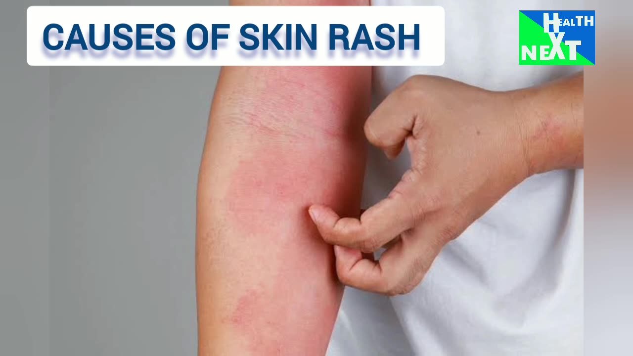 Causes of skin rashes