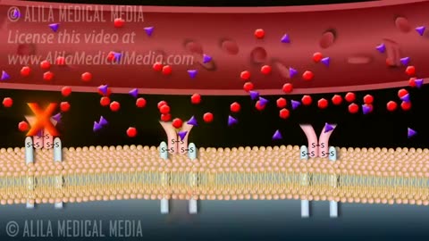 Diabetes Type 1 and Type 2, Animation