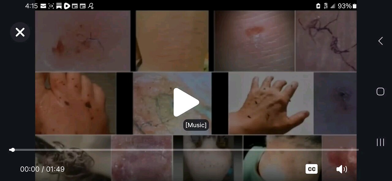 Chemtrails, nanotechnology dropping on us for years 1st Morgellons, now nano bots !