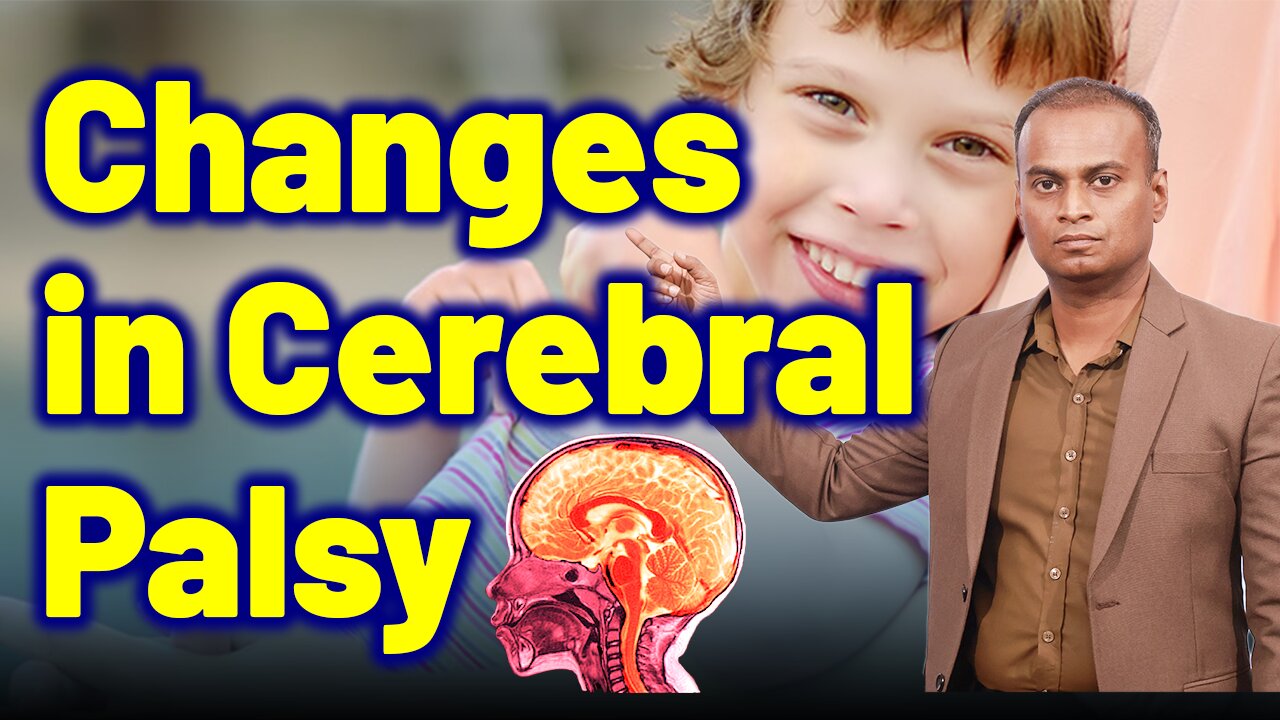 Body changes in Cerebral Palsy| Neurology Psychiatry. | Treatment Cure | Neurology Psychiatry |