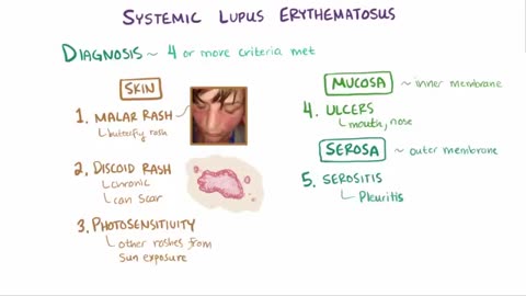 Systemic lupus erythematosus (SLE) - causes, symptoms, diagnosis & pathology