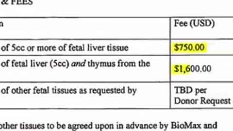 Undercover reporter stings Planned Parenthood selling harvested organs - this is really bad