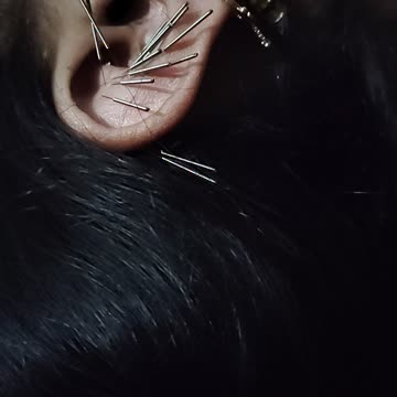 "Auricular Therapy: Unlocking the Power of Ear Acupuncture for Healing!"