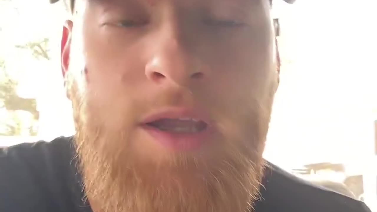 Trump is telling you to your faces that The Fall of the Dollar is Amongst Us