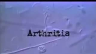 PARASITES HAVE KILLED MORE HUMANS THAN ALL WARS