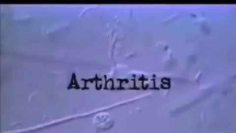 PARASITES HAVE KILLED MORE HUMANS THAN ALL WARS