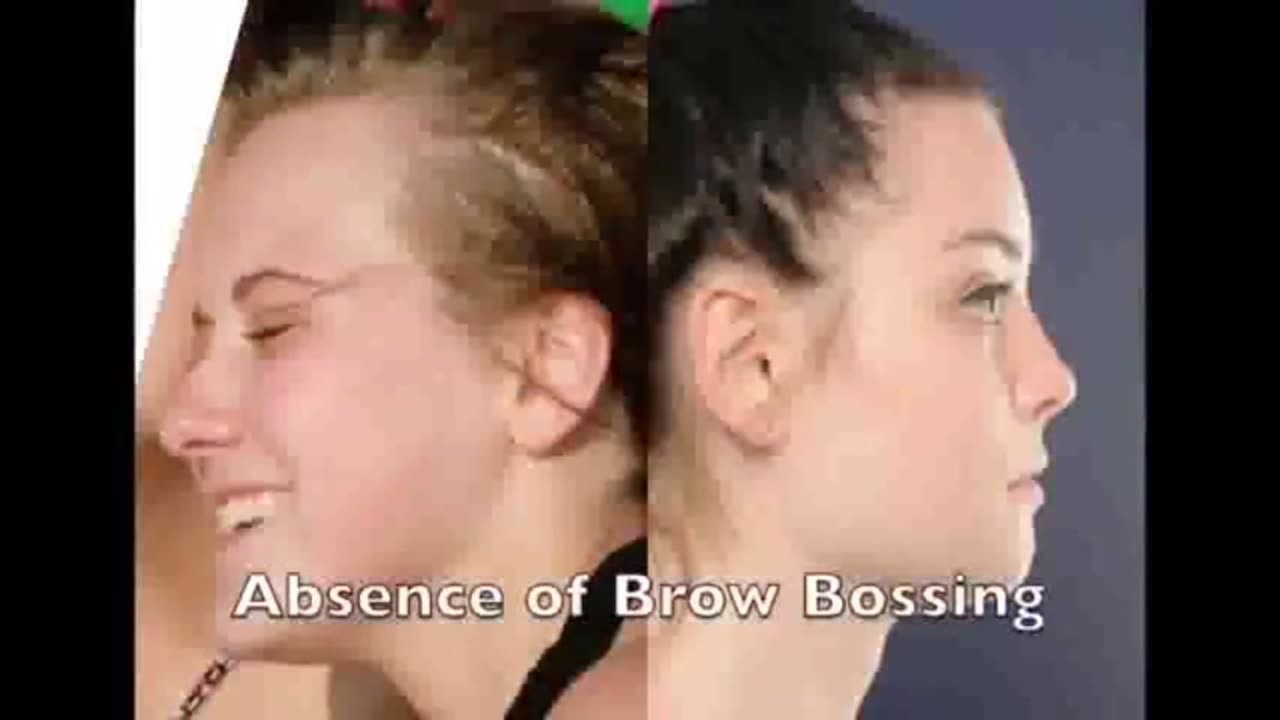 elite gender inversion the documentary